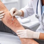 feridas-que-nao-cicatrizam