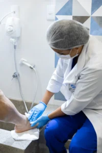 Tratamento da erisipela com avaliação clínica da perna de um paciente